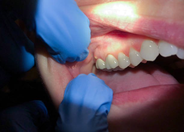 Best Emergency Dentist for Special Needs Patients in Bridgman, MI