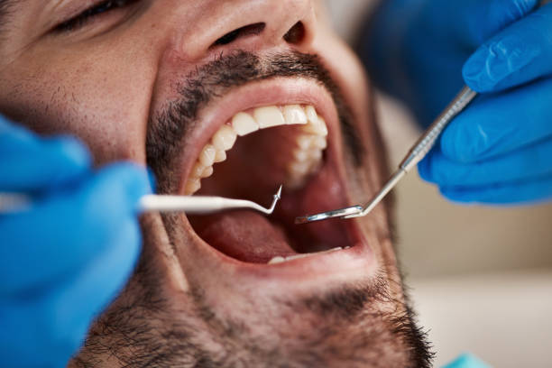 Best Emergency Dental Care for Abscessed Tooth in Bridgman, MI