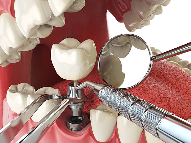 Best Urgent Dental Care for Toothache in Bridgman, MI